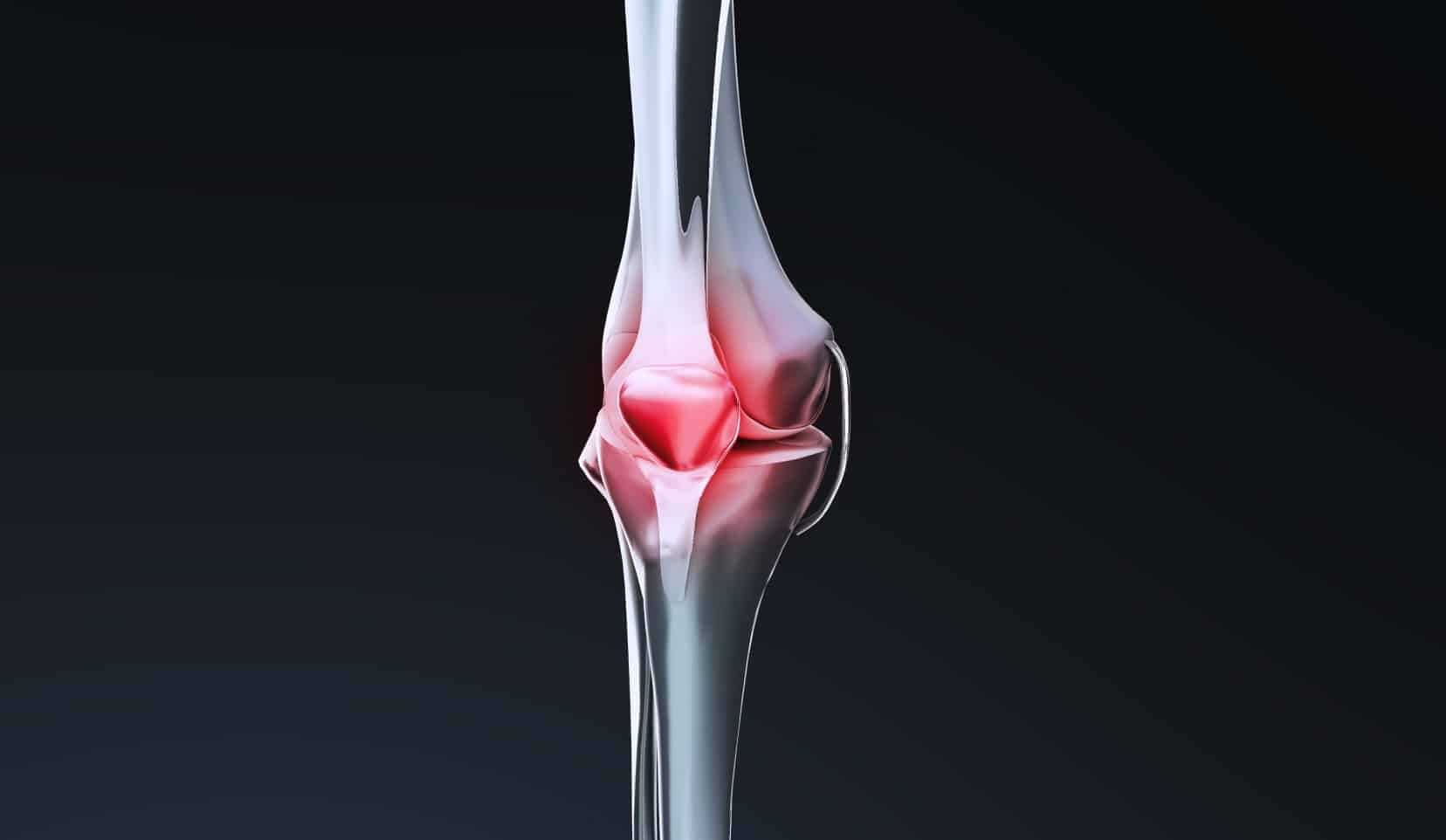 Entorse du genou : cause et traitement | spécialiste du genou | Dr Polle | Bois-Guillaume