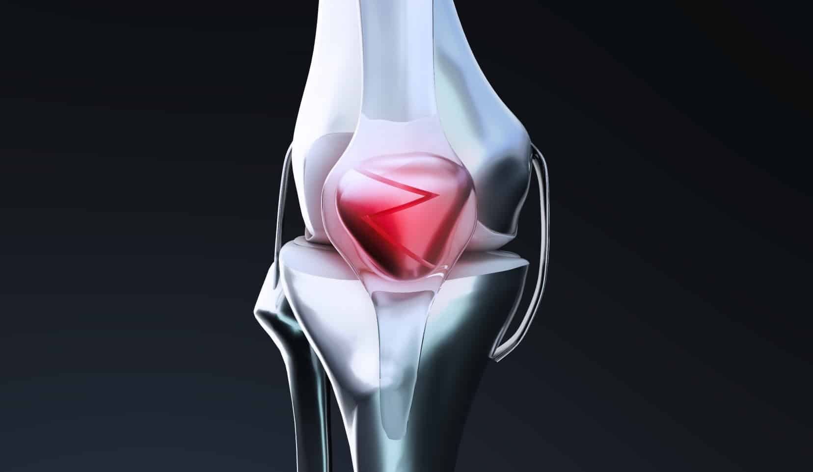 Symptômes et diagnostic de la tendinite du talon rotulien