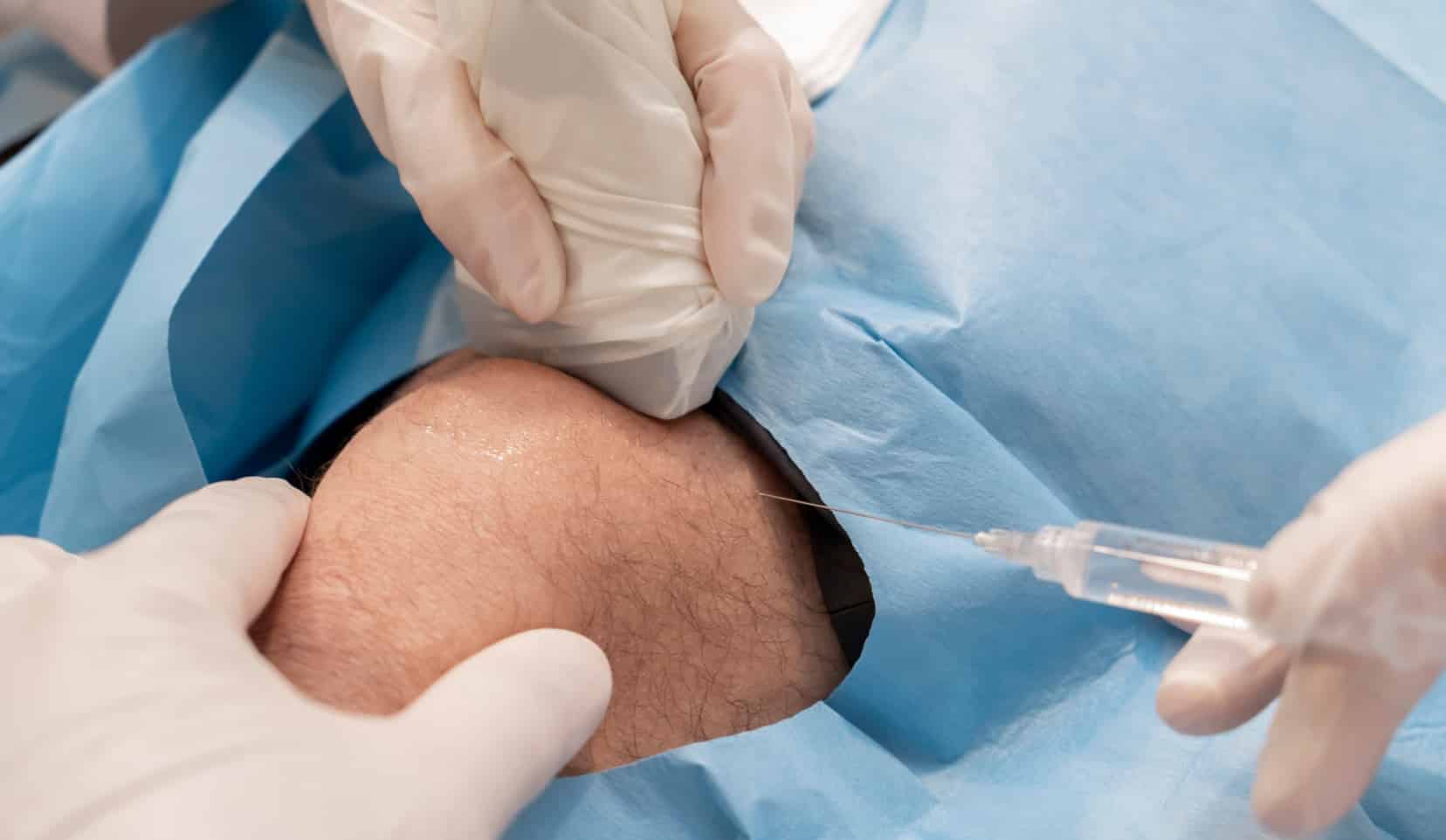 PRP arthrose : injection plasma | prp genou, prp arthrose | Bois-Guillaume | Dr Polle