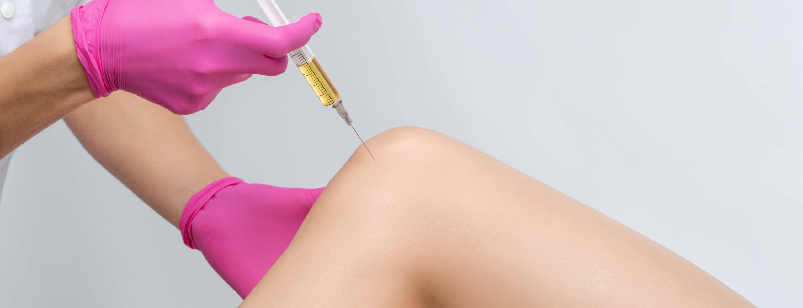 Quand faire des injections de PRP dans le genou ? |Dr Polle | Normandie
