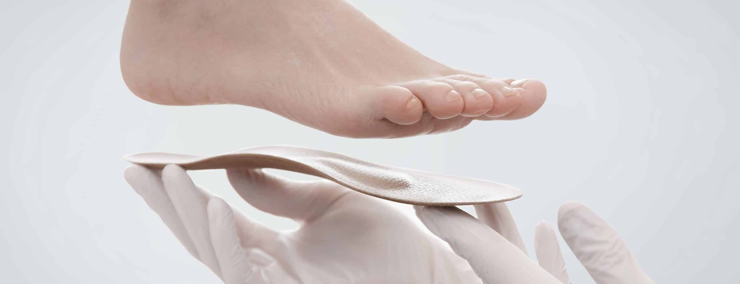 Quelles sont les conséquences de pieds plats ?|Dr Polle | Normandie