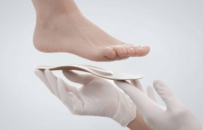 Quelles sont les conséquences de pieds plats ?|Dr Polle | Normandie